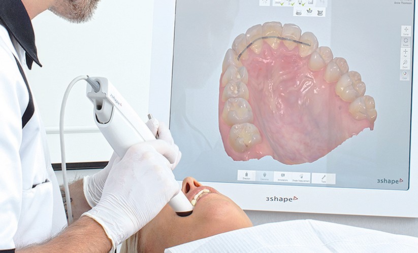 Digital Dental Scanner
