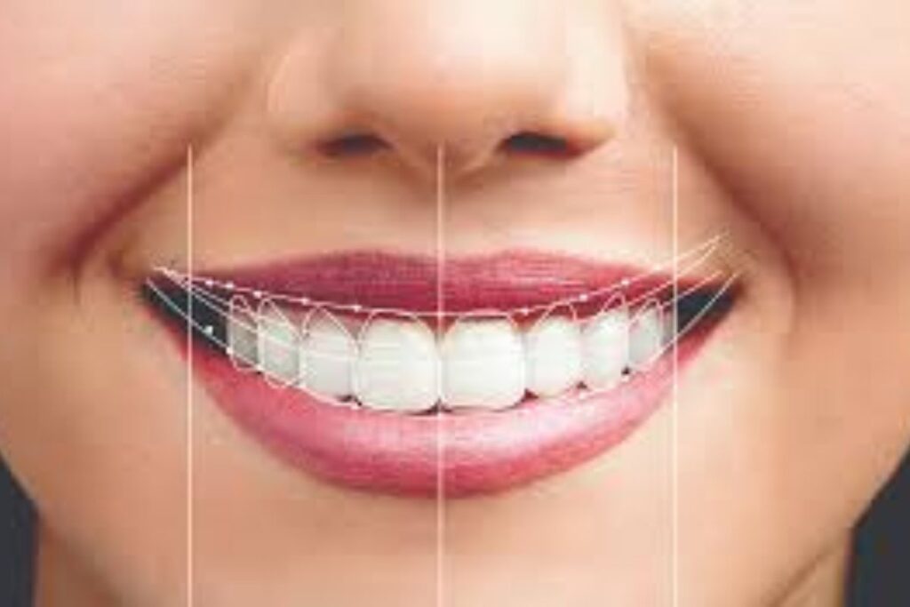 Cosmetic Dentistry & Smile design​