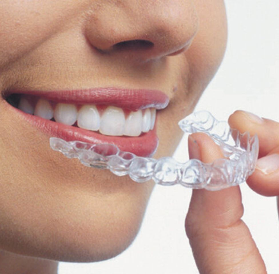 Invisalign Clear Aligner