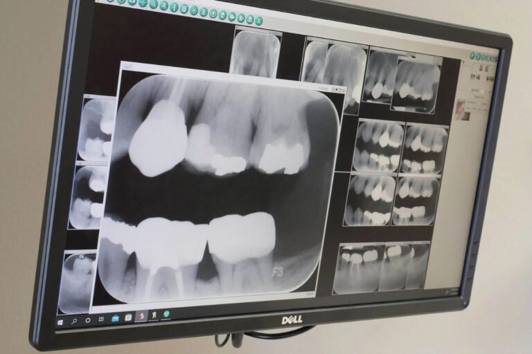 digital Dental X-ray